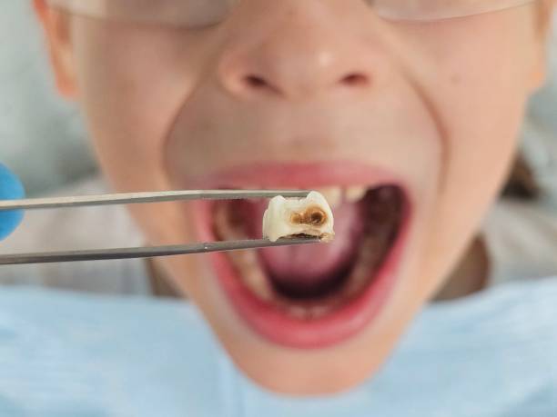 Best Pediatric Emergency Dentist in Pleasant View, UT